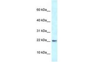 Image no. 1 for anti-RNA Binding Motif Protein 3 (RBM3) (AA 23-72) antibody (ABIN6747435) (RBM3 antibody  (AA 23-72))
