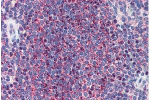 Human Spleen (formalin-fixed, paraffin-embedded) stained with LIN28 antibody ABIN462196 followed by biotinylated goat anti-rabbit IgG secondary antibody ABIN481713, alkaline phosphatase-streptavidin and chromogen. (LIN28A antibody  (N-Term))
