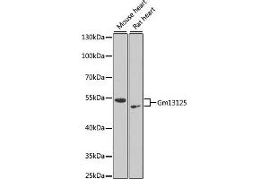 Western blot analysis of extracts of various cell lines, using Gm13125 antibody (ABIN6127294, ABIN6141172, ABIN6141175 and ABIN6216319) at 1:1000 dilution. (Pramel15 antibody  (AA 1-477))