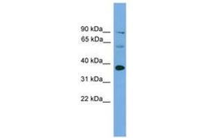 Image no. 1 for anti-Interferon Regulatory Factor 1 (IRF1) (AA 201-250) antibody (ABIN6744535) (IRF1 antibody  (AA 201-250))