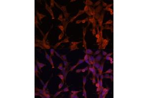 Immunofluorescence analysis of NIH-3T3 cells using UBE2G2 antibody (ABIN6130769, ABIN6149798, ABIN6149799 and ABIN6214653) at dilution of 1:100. (UBE2G2 antibody  (AA 1-165))