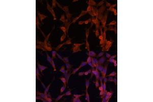 Immunofluorescence analysis of NIH-3T3 cells using UBE2G2 antibody (ABIN6130769, ABIN6149798, ABIN6149799 and ABIN6214653) at dilution of 1:100. (UBE2G2 antibody  (AA 1-165))