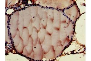 Immunohistochemistry of paraffin-embedded human thyroid tissue using ABIN7148476 at dilution of 1:100 (Contactin 6 antibody  (AA 706-812))
