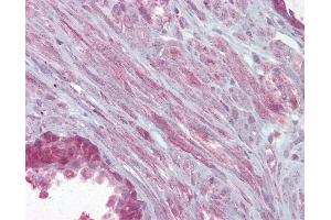 Anti-KCNMA1 antibody IHC of human prostate. (KCNMA1 antibody  (AA 1080-1129))