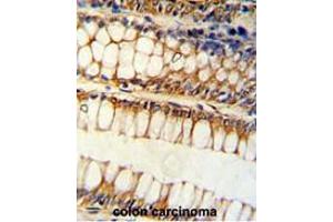 Immunohistochemistry (Paraffin-embedded Sections) (IHC (p)) image for anti-BCL2-Like 11 (Apoptosis Facilitator) (BCL2L11) (Middle Region) antibody (ABIN453531)