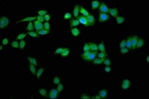 Immunofluorescence staining of PC-3 cells with ABIN7158949 at 1:266, counter-stained with DAPI. (MCTS1 antibody  (AA 1-181))