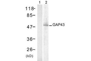 Western blot analysis of extract from mouse brain tissue, using GAP43 (Ab-41) antibody (E021273, Lane 1 and 2). (GAP43 antibody)