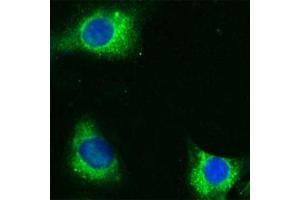 Human Melanoma cell line C 32 was cultured overnight on round cover slides placed in a 24 well tissue culture plate. (CD36 antibody  (Extracellular Domain))