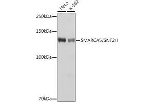 Western blot analysis of extracts of various cell lines, using SM/SM/SNF2H Rabbit mAb (ABIN7270656) at 1:1000 dilution. (SMARCA5 antibody)