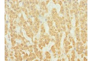 Immunohistochemistry of paraffin-embedded human adrenal gland tissue using ABIN7167252 at dilution of 1:100 (RAB23 antibody  (AA 1-237))