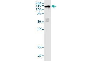 JARID1D monoclonal antibody (M03), clone 4C6. (KDM5D antibody  (AA 127-230))