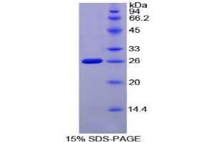 SDS-PAGE analysis of Mouse F8A1 Protein. (Coagulation Factor VIII-Associated 1 (F8A1) Protein)