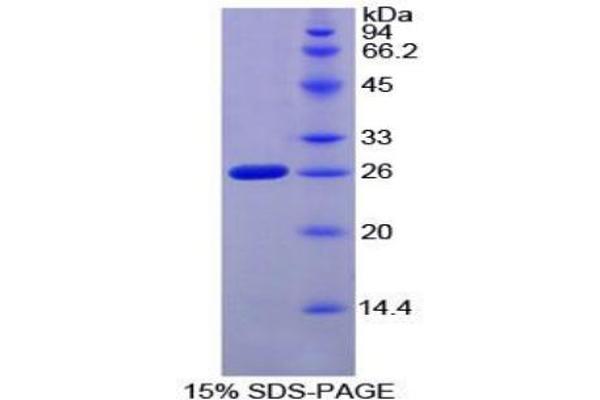 Coagulation Factor VIII-Associated 1 (F8A1) Protéine