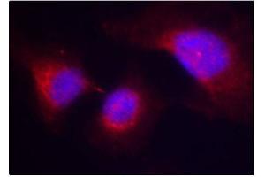 Immunofluorescence (IF) image for anti-Spleen tyrosine Kinase (SYK) (pTyr323) antibody (ABIN1870661) (SYK antibody  (pTyr323))