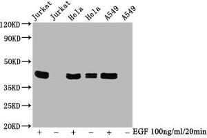 Western Blot Positive WB detected in Jurkat whole cell lysate 72ela whole cell lysate 65549 whole cell lysate(treated with EGF or not) All lanes Phospho-MAPK3 antibody at 0. (Recombinant ERK1 antibody  (pThr183, pThr202, pThr204, pTyr187))