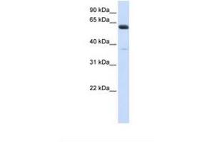 Image no. 1 for anti-Asparagine-Linked Glycosylation 6, alpha-1,3-Glucosyltransferase Homolog (ALG6) (AA 74-123) antibody (ABIN6738286) (ALG6 antibody  (AA 74-123))