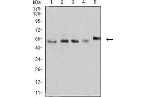 Western Blotting (WB) image for anti-CD2 (CD2) (AA 25-140) antibody (ABIN5542296)
