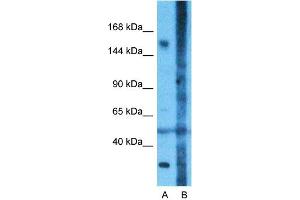 Host:  Rabbit  Target Name:  CNTNAP1  Sample Type:  Fetal Lung  Lane A:  Primary Antibody  Lane B:  Primary Antibody + Blocking Peptide  Primary Antibody Concentration:  1ug/ml  Peptide Concentration:  5ug/ml  Lysate Quantity:  25ug/lane/Lane  Gel Concentration:  0. (CNTNAP1 antibody  (N-Term))