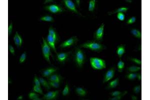 Immunofluorescence staining of Hela Cells with ABIN7127792 at 1:50, counter-stained with DAPI. (Recombinant RHEB antibody)