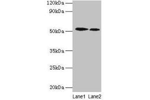 Western blot All lanes: RPS6KB2 antibody at 2 μg/mL Lane 1: EC109 whole cell lysate Lane 2: 293T whole cell lysate Secondary Goat polyclonal to rabbit IgG at 1/15000 dilution Predicted band size: 54, 17 kDa Observed band size: 54 kDa (RPS6KB2 antibody  (AA 1-210))