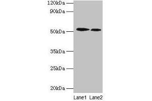 Western blot All lanes: RPS6KB2 antibody at 2 μg/mL Lane 1: EC109 whole cell lysate Lane 2: 293T whole cell lysate Secondary Goat polyclonal to rabbit IgG at 1/15000 dilution Predicted band size: 54, 17 kDa Observed band size: 54 kDa