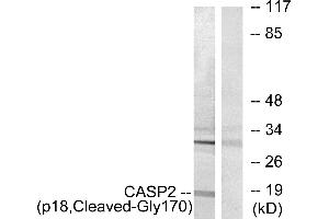 Western blot analysis of extracts from Jurkat cells, treated with etoposide (25uM, 24hours), using CASP2 (p18, Cleaved-Gly170) antibody. (Caspase 2 antibody  (Cleaved-Gly170, Subunit p18))