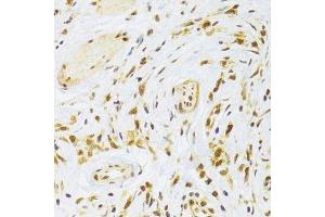 Immunohistochemistry (Paraffin-embedded Sections) (IHC (p)) image for anti-Ribosomal Protein L13 (RPL13) (AA 1-211) antibody (ABIN6147109)