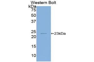Western blot analysis of the recombinant protein. (IL-1 beta antibody  (AA 63-247))