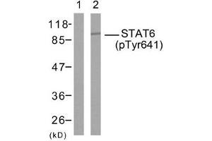 Western blot analysis of extract from HeLa cells, using STAT6 (phospho-Tyr641) antibody (E011050) IL-4 - + (STAT6 antibody  (pTyr641))