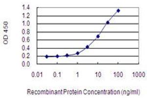 Detection limit for recombinant GST tagged NRAP is 0. (NRAP antibody  (AA 1640-1727))