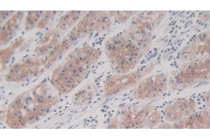 Detection of IL8 in Human Stomach Tissue using Monoclonal Antibody to Interleukin 8 (IL8) (IL-8 antibody  (AA 23-101))