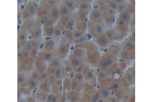 Used in DAB staining on fromalin fixed paraffin- embedded Kidney tissue (CROT antibody  (AA 410-612))