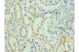 Immunohistochemistry of paraffin-embedded human kidney tissue using ABIN7176713 at dilution of 1:100 (SLC39A6 antibody  (AA 170-320))