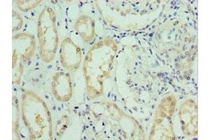 Immunohistochemistry of paraffin-embedded human kidney tissue using ABIN7176713 at dilution of 1:100