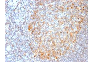 Formalin-fixed, paraffin-embedded human Tonsil stained with MALT1 Recombinant Rabbit Monoclonal Antibody (MT1/3159R). (Recombinant MALT1 antibody  (AA 701-808))