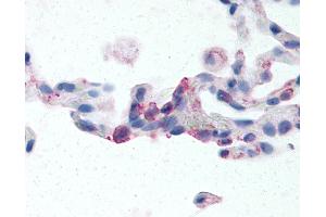 Anti-EMR2 antibody IHC of human lung, neutrophils. (EMR2 antibody  (N-Term))