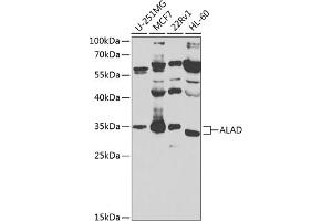 Western blot analysis of extracts of various cell lines, using ALAD antibody (ABIN6129892, ABIN6136750, ABIN6136752 and ABIN6224446) at 1:1000 dilution. (ALAD antibody  (AA 1-330))