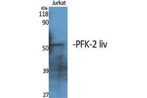 Western Blot (WB) analysis of specific cells using PFK-2 liv Polyclonal Antibody. (PFK-2 LIV (C-Term) antibody)