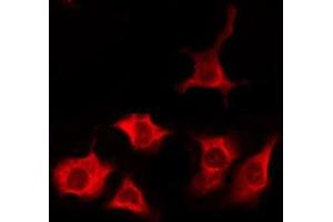 TAS2R1 antibody  (N-Term)