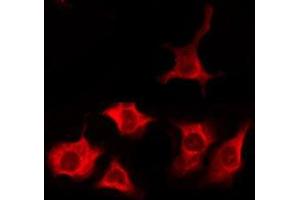 ABIN6276226 staining MCF7 by IF/ICC. (TAS2R1 antibody  (N-Term))