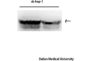 Western Blot (WB) analysis: Please contact us for more details. (Vimentin antibody)