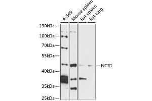 Western blot analysis of extracts of various cell lines, using NCR1 antibody (ABIN7268833) at 1:3000 dilution. (NCR1 antibody  (AA 151-303))