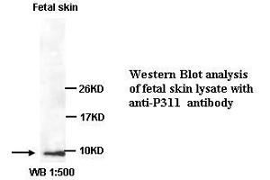Image no. 1 for anti-Chromosome 5 Open Reading Frame 13 (C5orf13) (C-Term) antibody (ABIN791087)