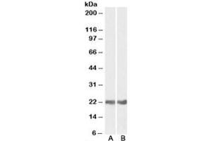 Western blot testing of mouse [A] and rat [B] eye lysates with CRYAB antibody at 0. (CRYAB antibody)