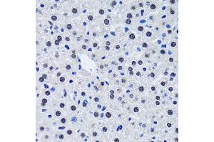 Immunohistochemistry of paraffin-embedded rat liver using BIRC7 antibody. (BIRC7 antibody)