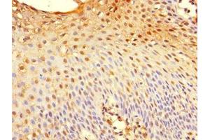 Immunohistochemistry of paraffin-embedded human tonsil tissue using ABIN7173626 at dilution of 1:100 (TSC22D3 antibody  (AA 58-134))