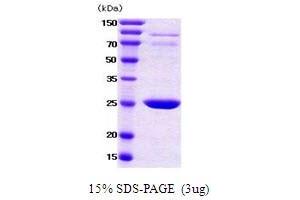 Figure annotation denotes ug of protein loaded and % gel used. (YWHAB Protein (AA 1-246))