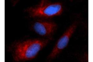 Immunofluorescence (IF) image for anti-Keratin 8 (KRT8) (AA 1-483) antibody (PE) (ABIN5567068) (KRT8 antibody  (AA 1-483) (PE))