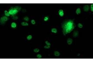 Anti-TP53 mouse monoclonal antibody (ABIN2454484) immunofluorescent staining of COS7 cells transiently transfected by pCMV6-ENTRY TP53 (RC200003). (p53 antibody)