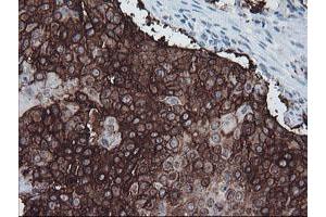 Image no. 8 for anti-FXYD Domain Containing Ion Transport Regulator 3 (FXYD3) antibody (ABIN1498341)